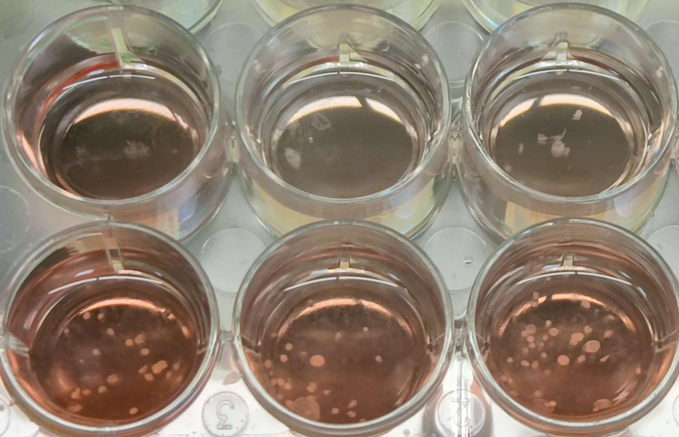 Brain organoids in a cell culture