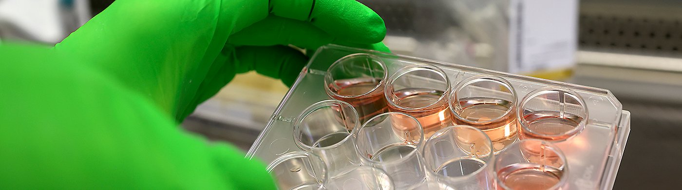 En forskare håller i en hålplatta med rosafärgad vätska